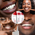 Load image into Gallery viewer, SP-4 Dentifrice blanchissant probiotique Gestion de la santé bucco-dentaire(Élimine des années de taches)
